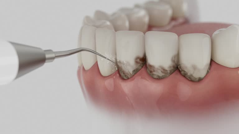 Reliable Dental Implants contractor in Palo Cedro, CA by Smile Center Dentistry